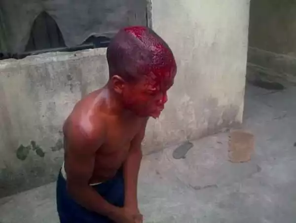 Wow! Young boy left a bloody mess after brutal beating by his guardian (photos)